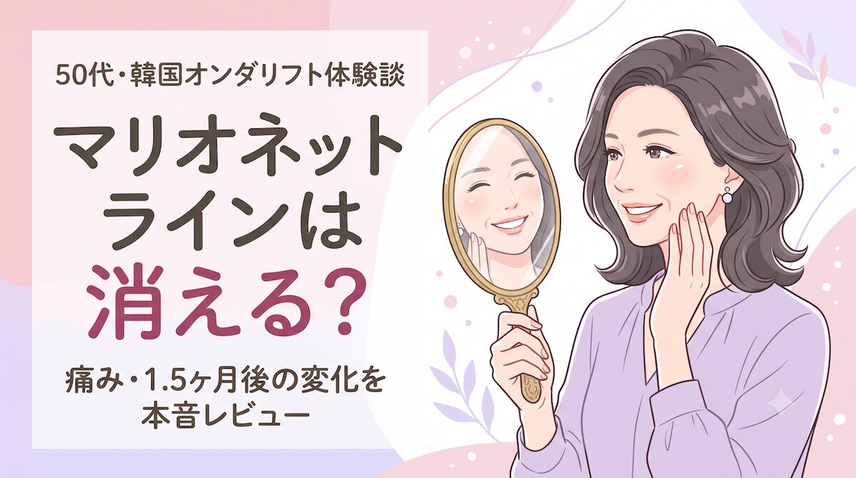 【50代体験談】オンダリフトでマリオネットラインは消える?痛さと1.5ヶ月後のたるみ引き締め効果を本音レビューのアイキャッチ画像